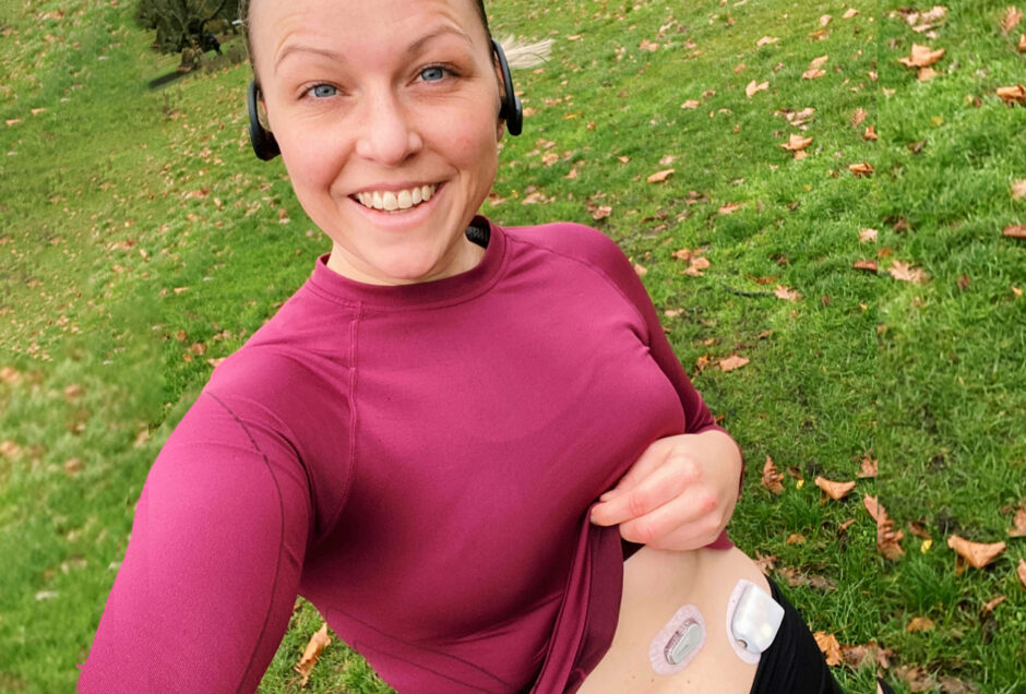 Jen Grieves out running holding up her running top to show a Dexcom and Omnipod stuck to her abdomen